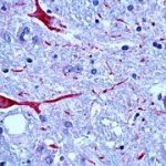 terceira idade e o sistema imunológico